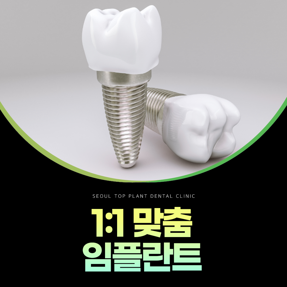 수면 임플란트