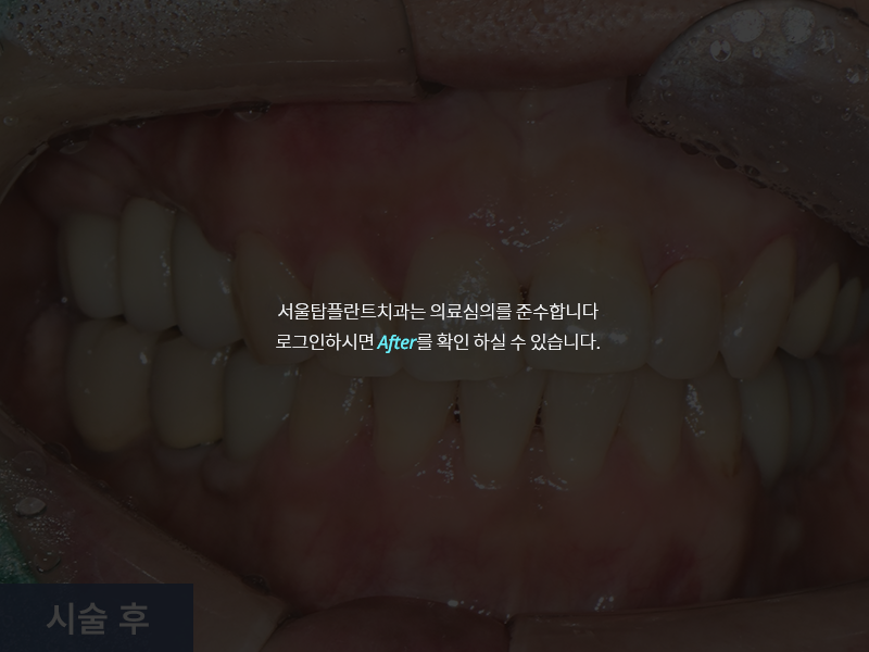 일반진료 사례 1