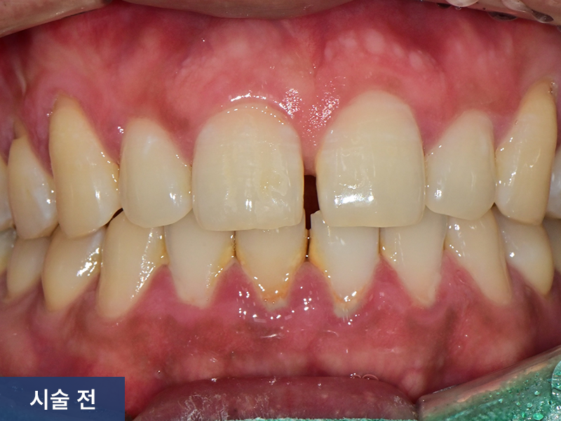 일반진료 사례 2