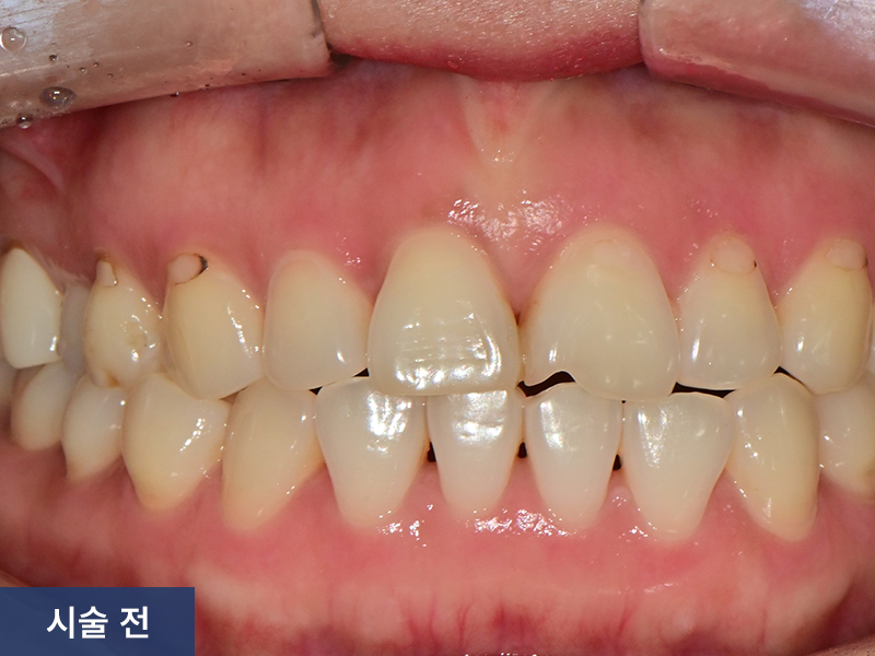 일반진료 사례 3