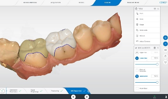 자연스러운 색상의 정밀한 3D 영상