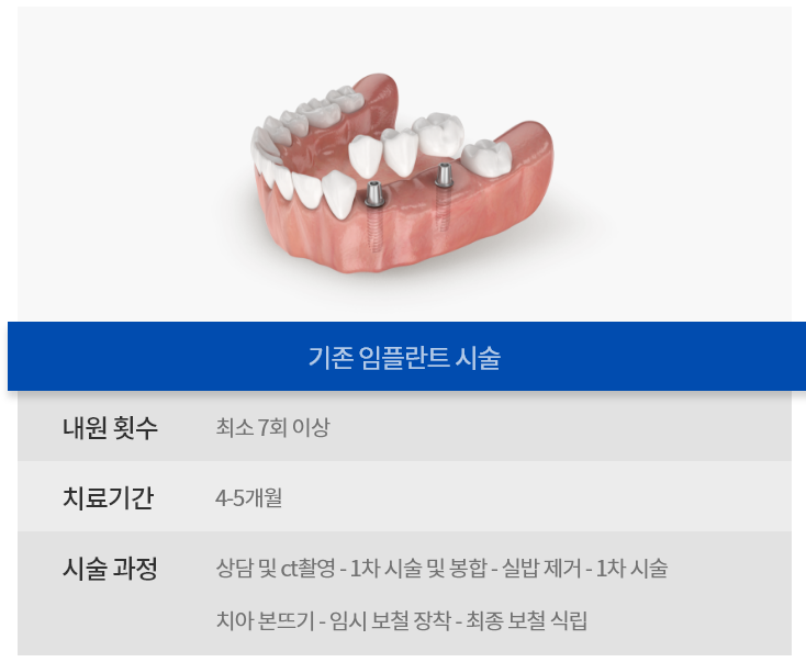 네비게이션 임플란트 시술 비교