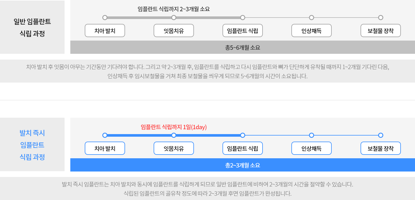 일반 임플란트 VS 원데이 임플란트